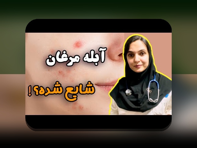 آیا زونا واگیر دارد؟ همه چیز درباره انتقال و خطرات زونا در زندگی روزمره